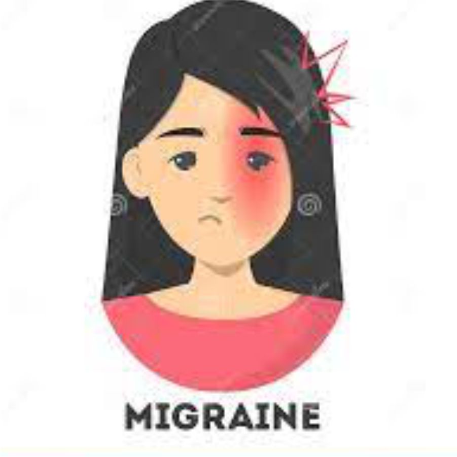 Migrain